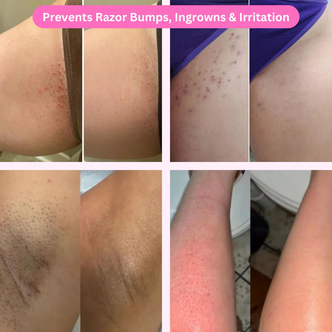 ShaveSmooth™️ - 5-in-1 Waterproof Electric Shaver for Women
