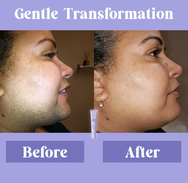 Hoygi™️ - Facial Hair Removal Cream